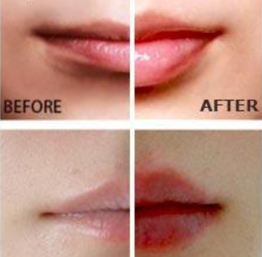 Plumper de labios eléctrico Miracle Lip Plumper - vista 4